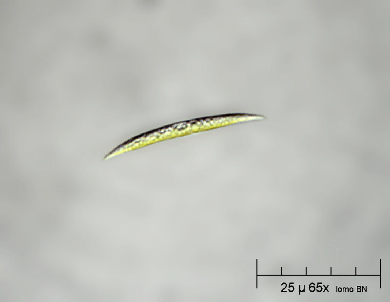 Ankistrodesmus sp.  ???????