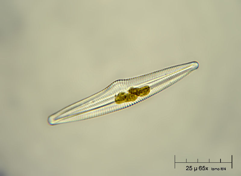 Navicula sp. -  deforme