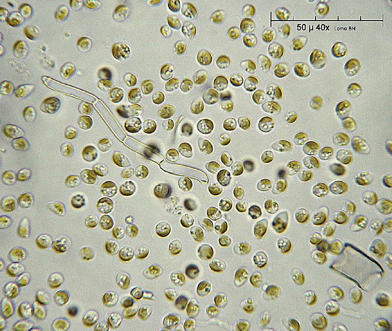 assembramento di flagellati  -  ( Chromulina sp. )