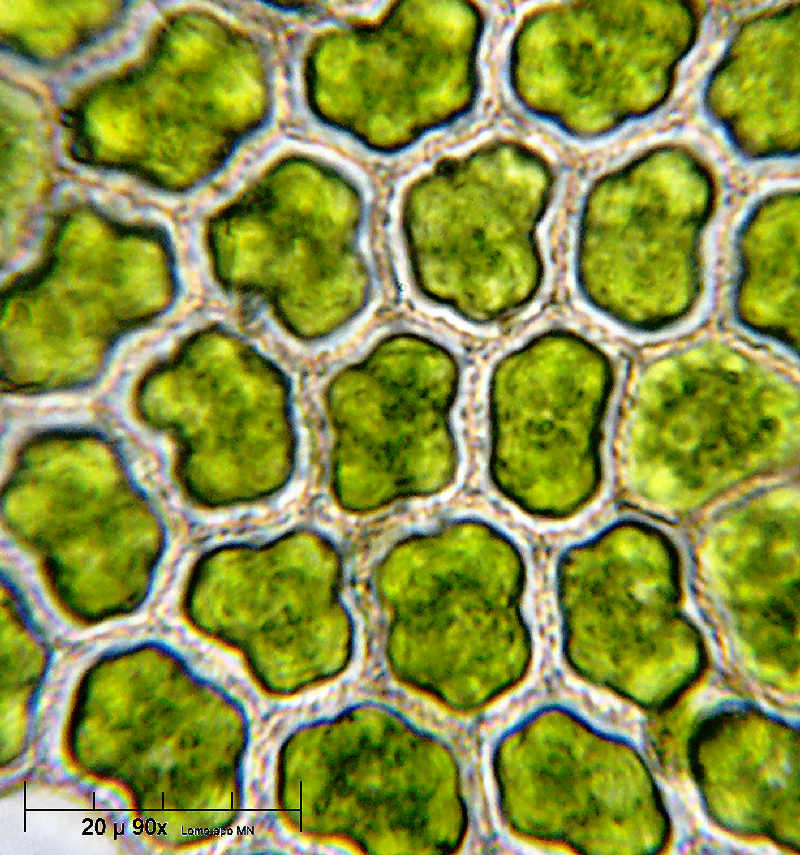 frammento di Pediastrum boryanum