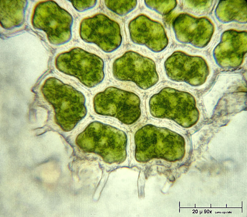 frammento di Pediastrum boryanum