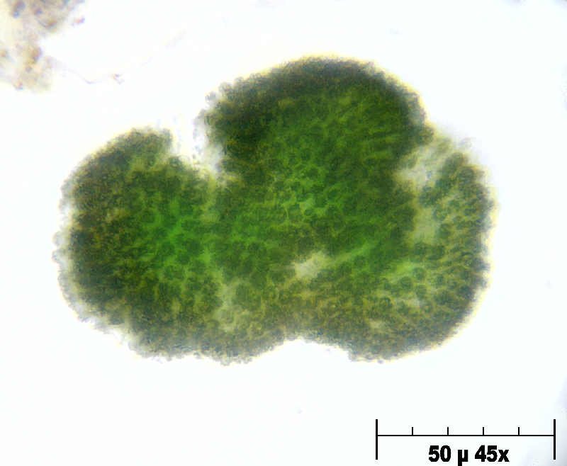 Woronichinia sp. o Microcystis aeruginosa ?