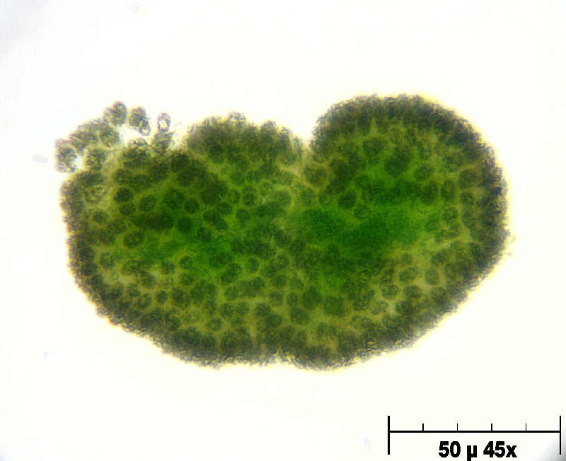 Woronichinia sp. o Microcystis aeruginosa ?