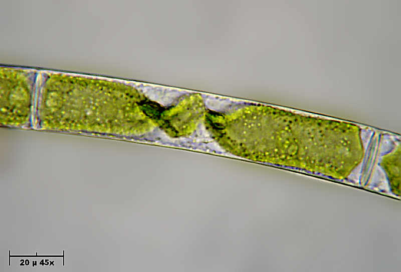 Alga caramella - Mougeotia sp.
