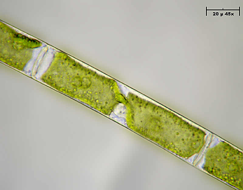 Alga caramella - Mougeotia sp.