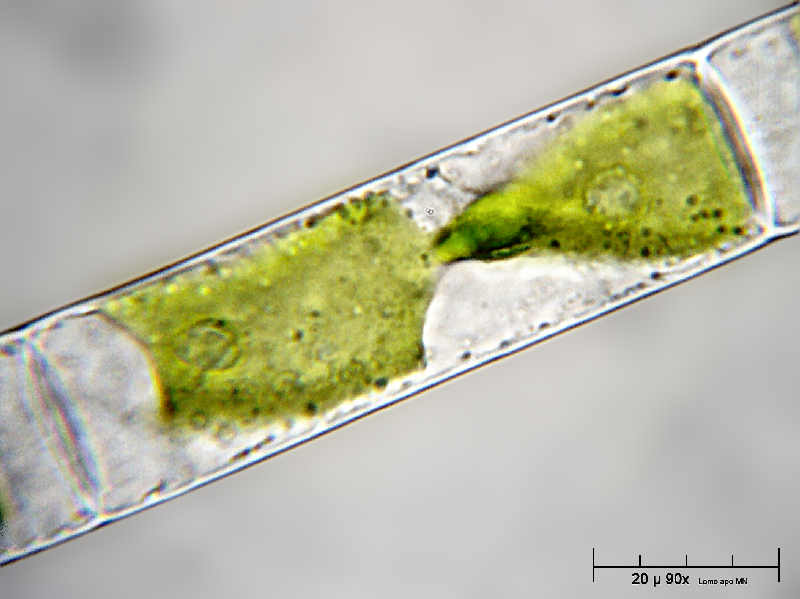 Alga caramella - Mougeotia sp.
