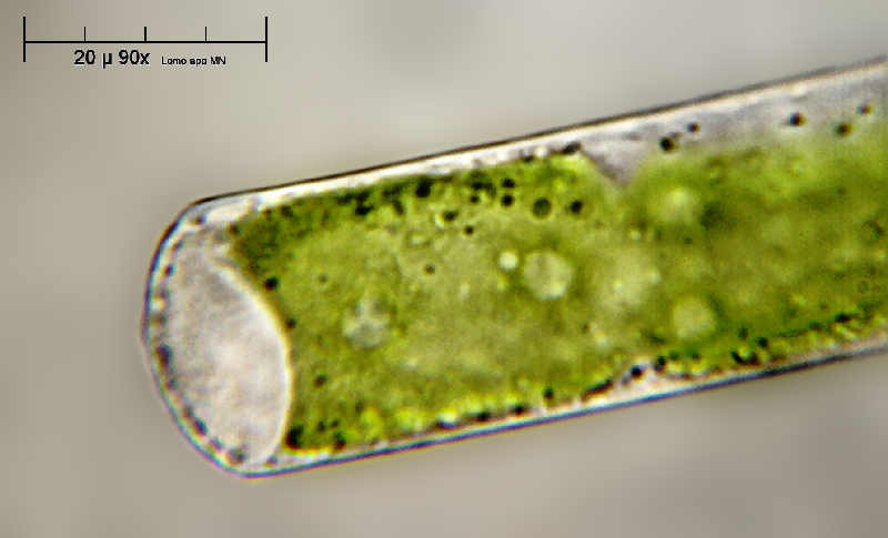 Alga caramella - Mougeotia sp.