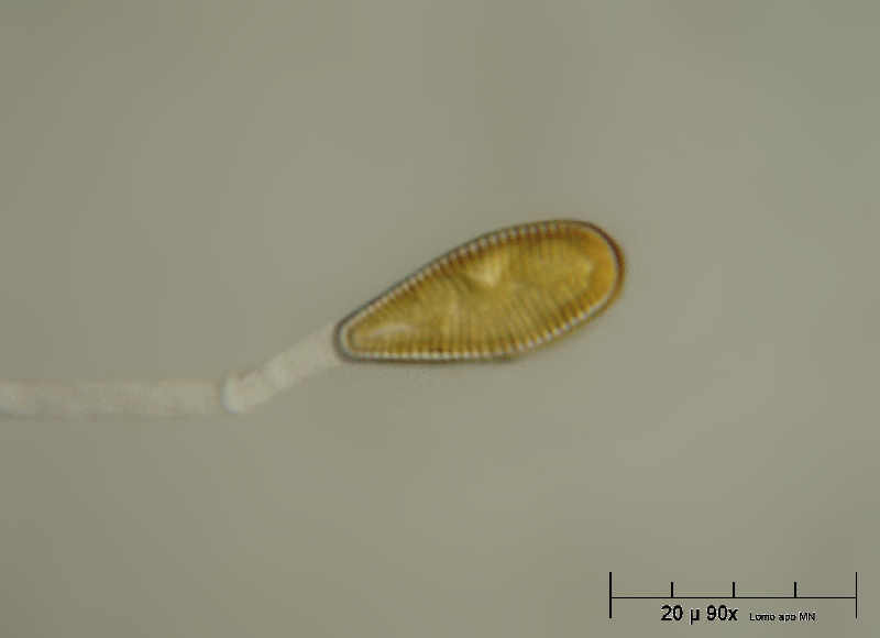 Gomphonema sp.