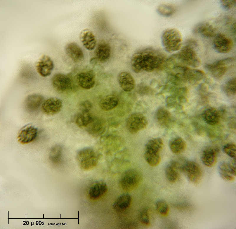 Woronichinia sp. o Microcystis aeruginosa ?