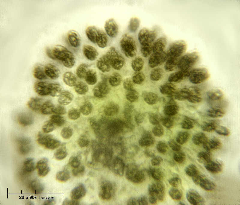 Woronichinia sp. o Microcystis aeruginosa ?