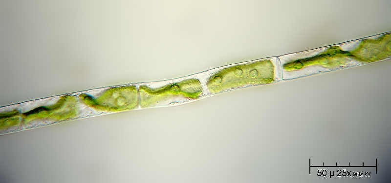 Alga caramella - Mougeotia sp.