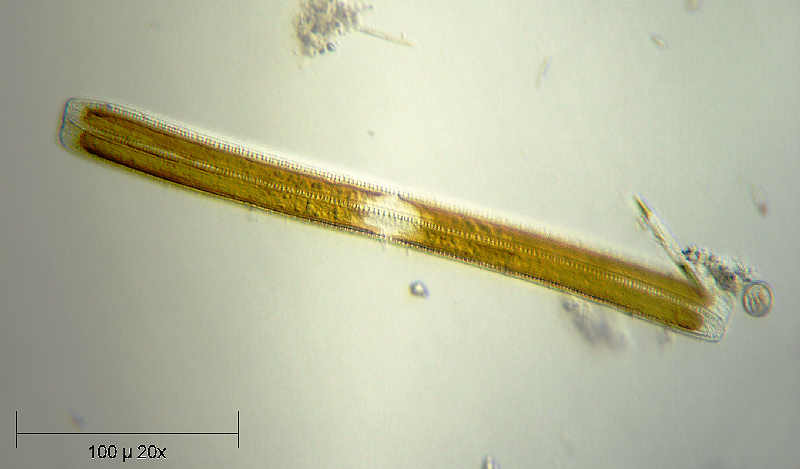 Nitzschia sigmoide