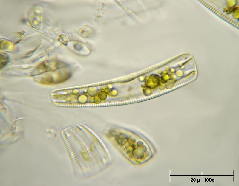 Rhoicosphenia sp. - 100x oil