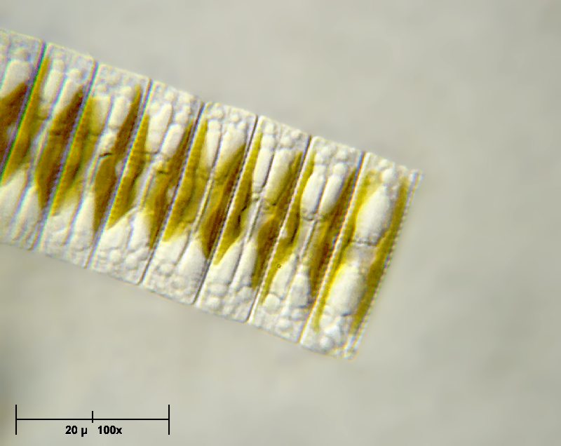 Fragilaria sp. 100x oil