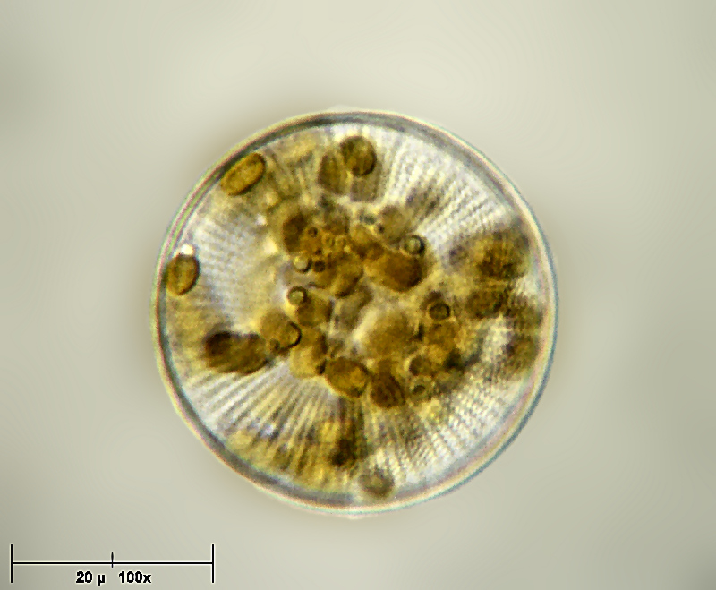 Cyclotella stelligera ? -- no Stephanodiscus sp.