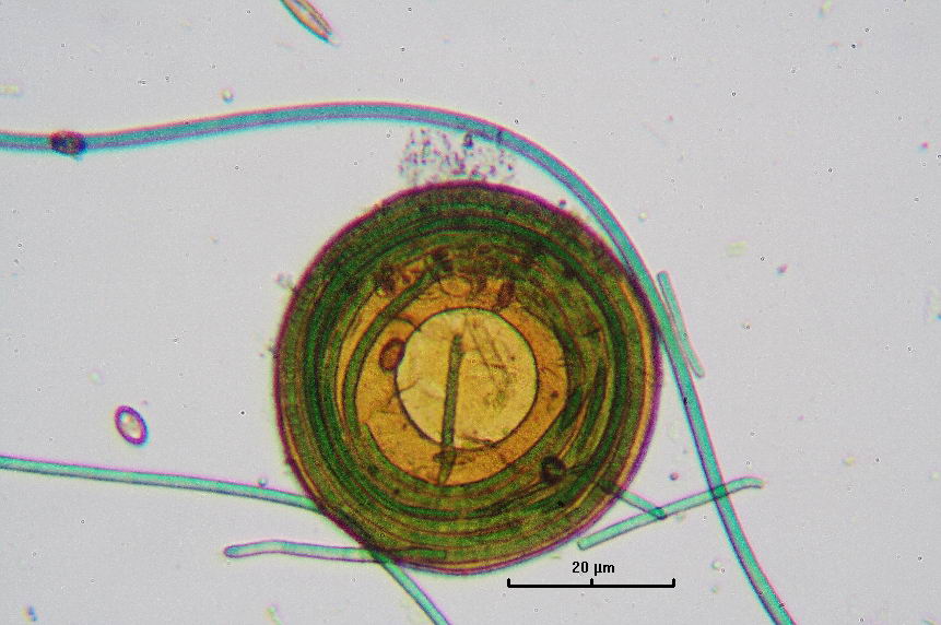 Tecamebe con cianobatteri