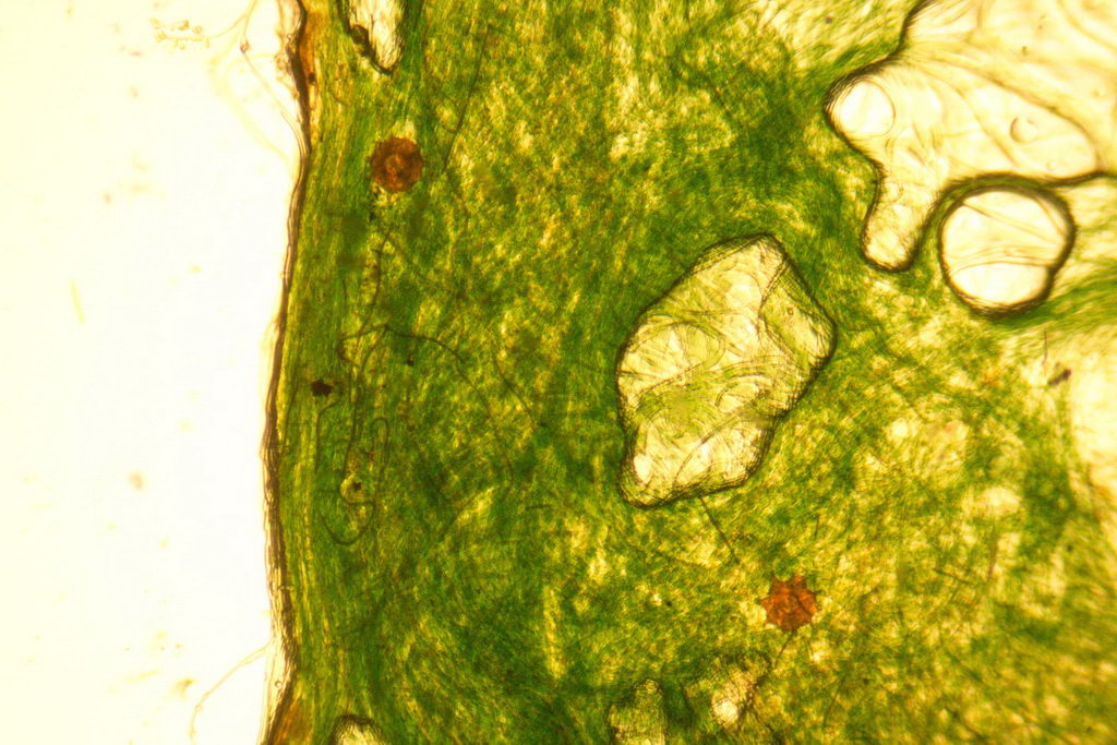 arcelle dentate