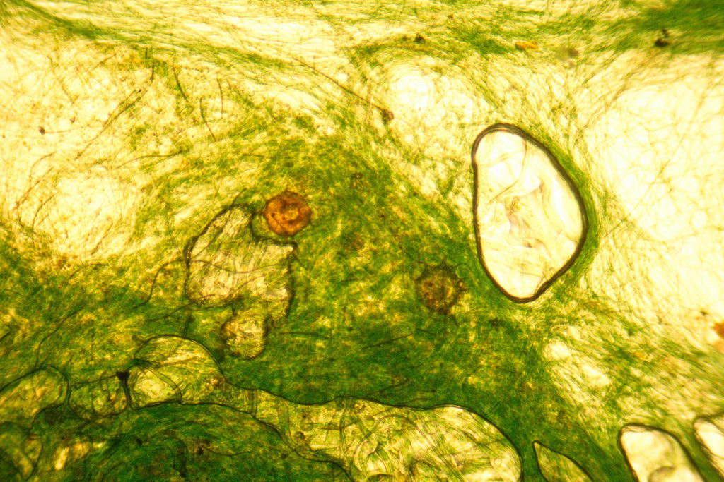 arcelle dentate