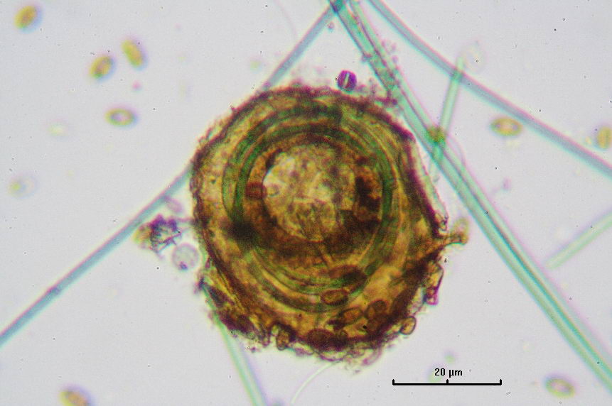 Tecamebe con cianobatteri