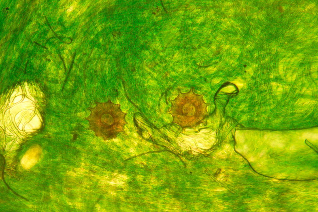 arcelle dentate