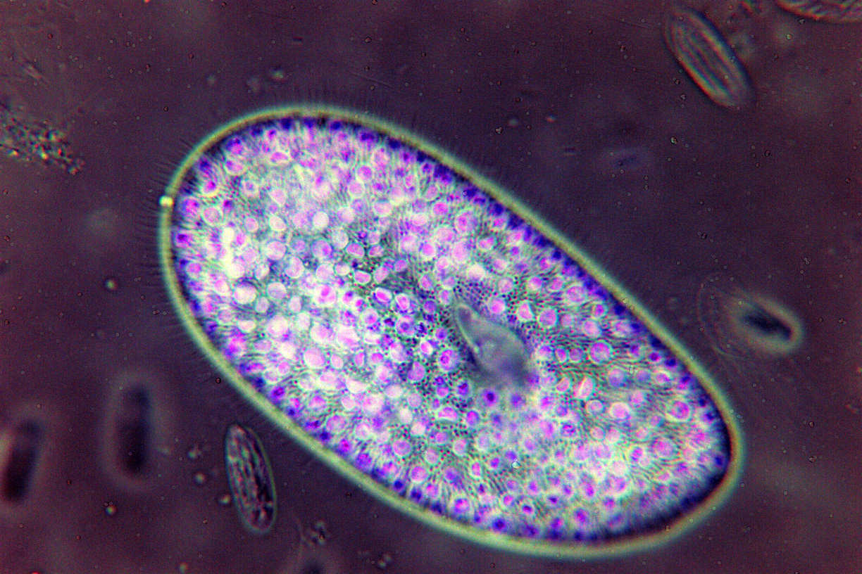 Paramecium bursaria?