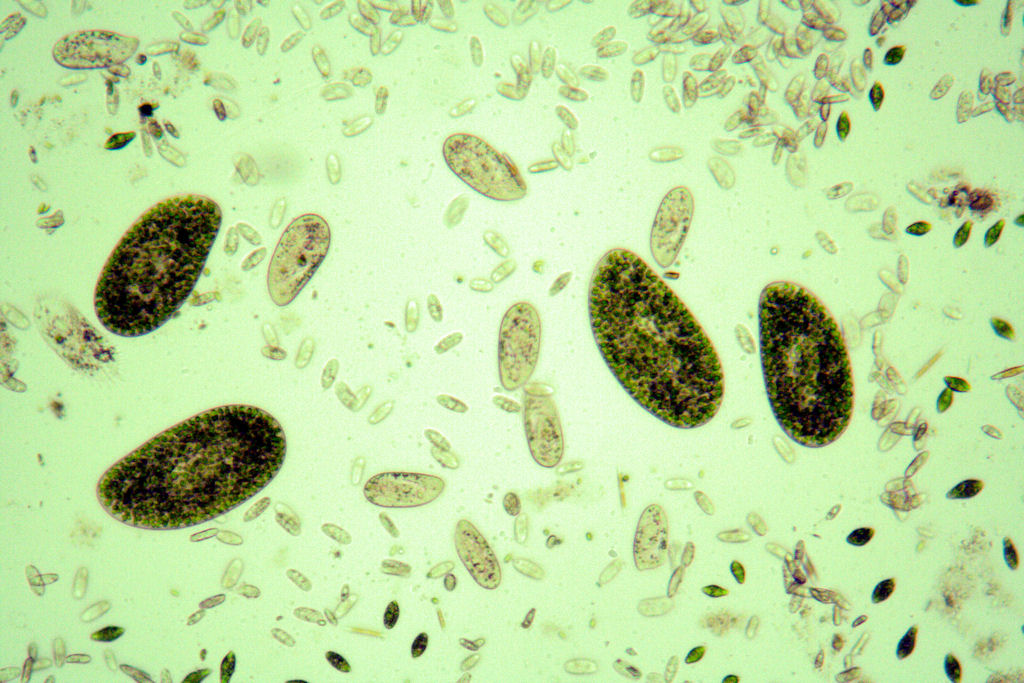 Paramecium bursaria?