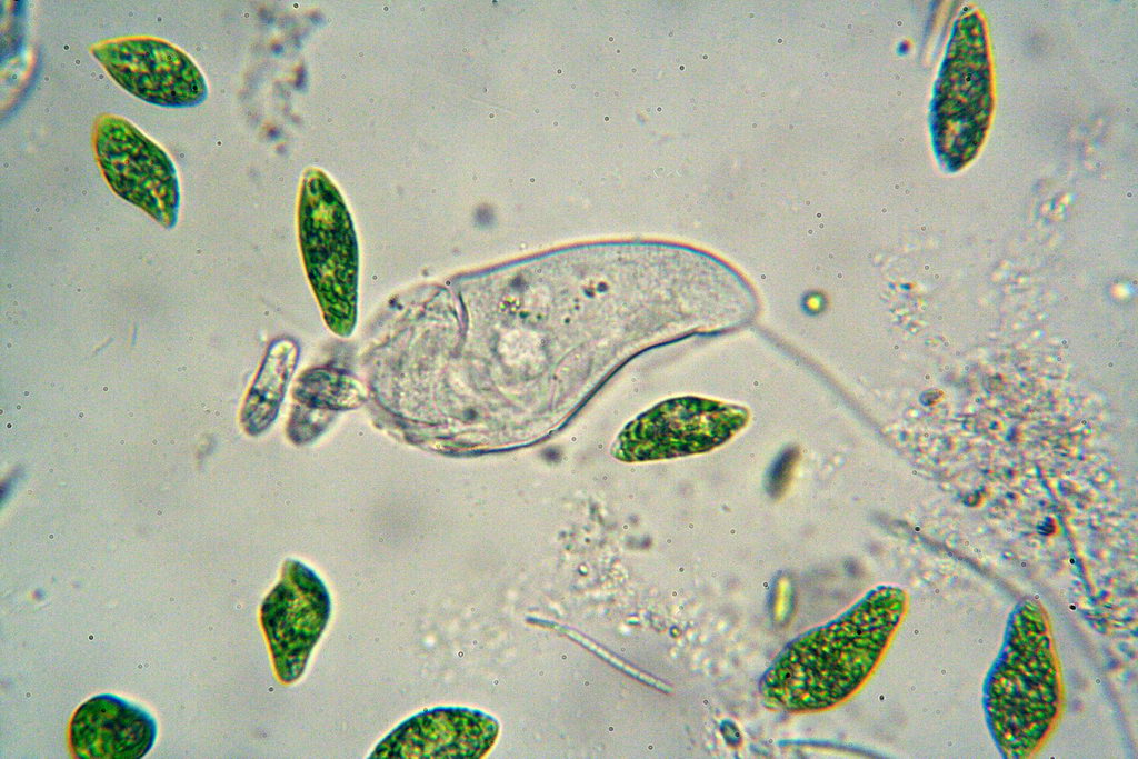 vorticella