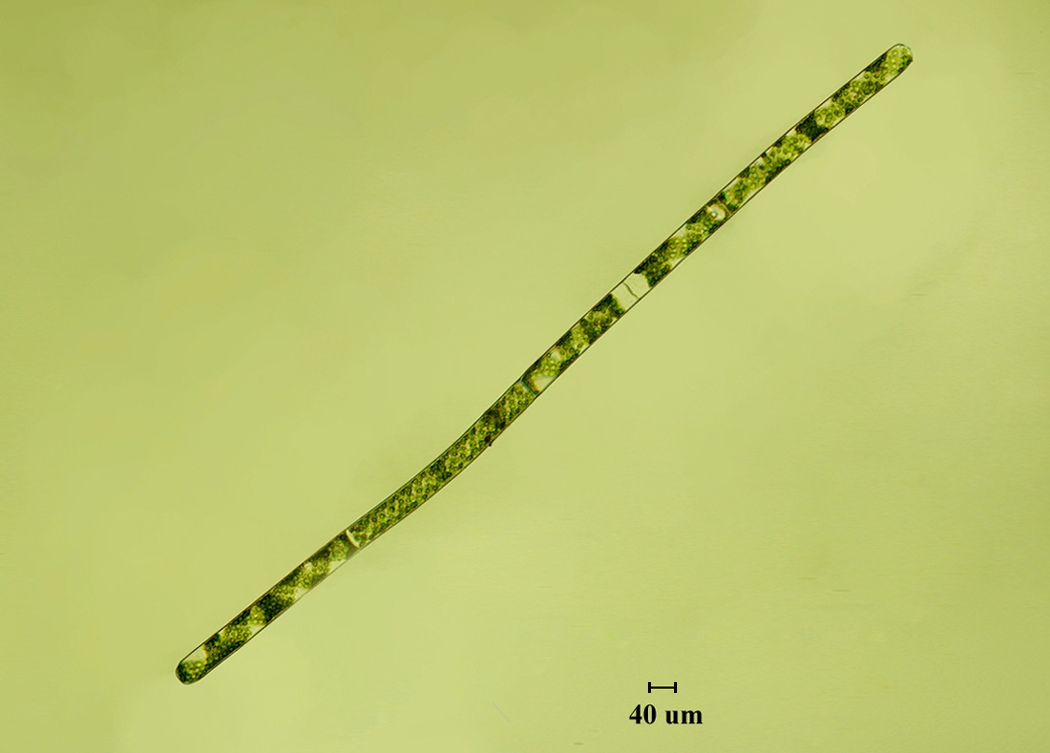 Spirogyra