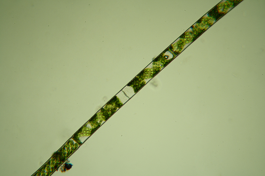 Spirogyra