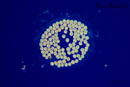 Microcystis illuminazione di rheinberg