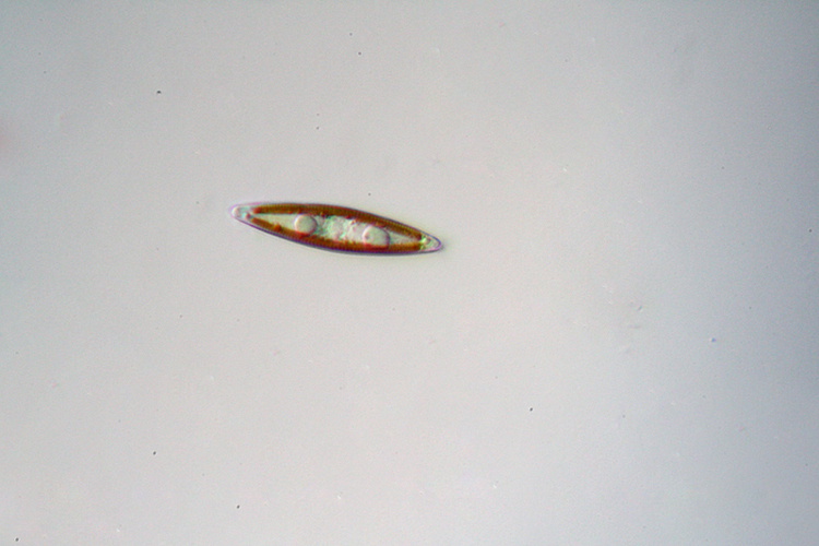 Navicula sp