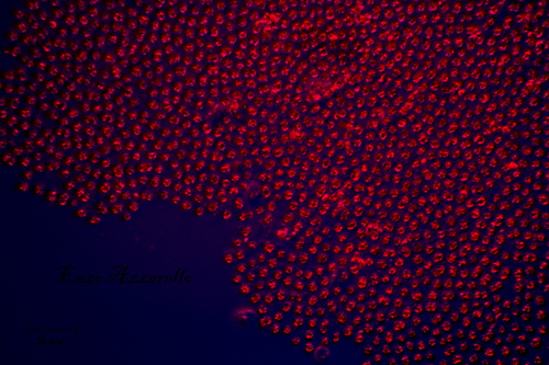 Microcystis illuminazione di rheinberg