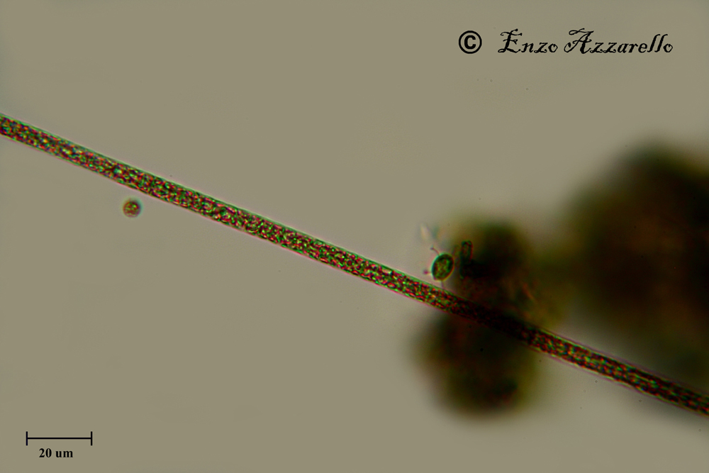 Oscillatoria rubescens ob. 40x