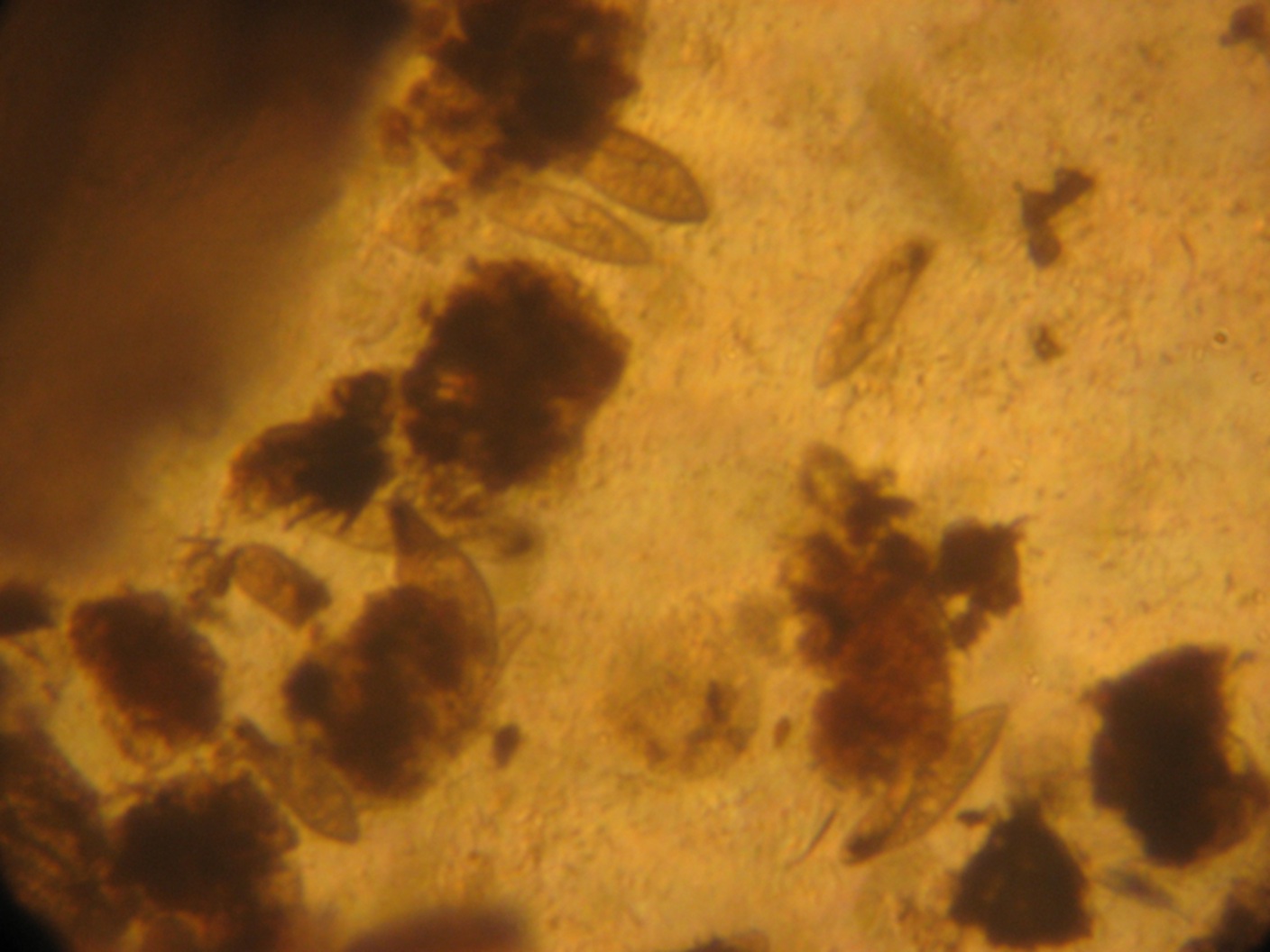 ricerca protozoi