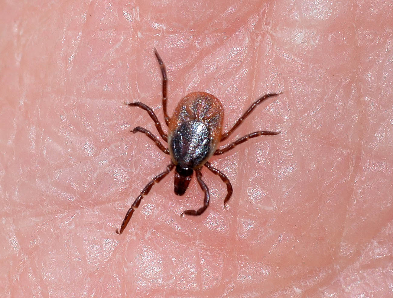 Zecca sventata: femmina di Ixodes sp. (Ixodidae)