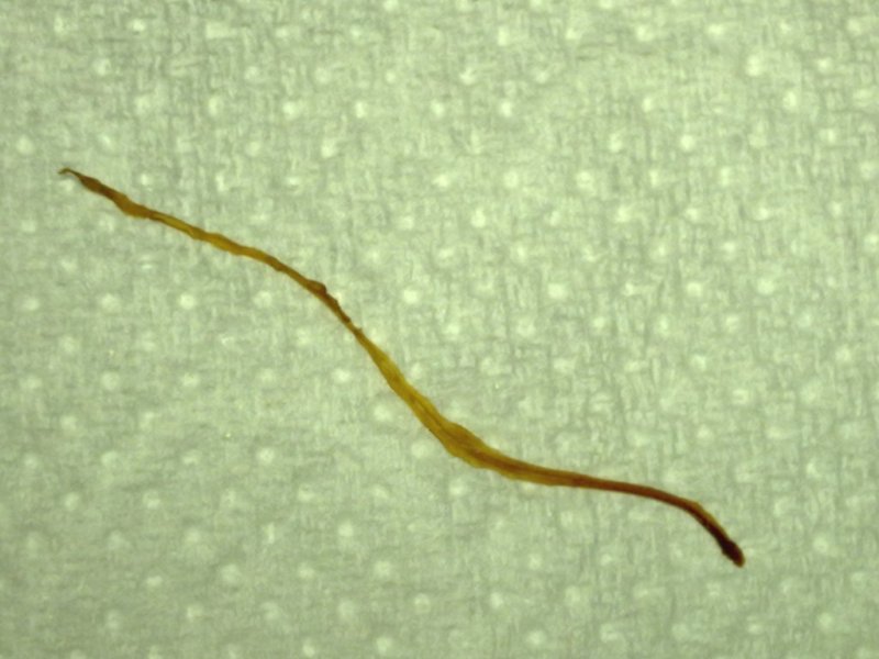 Nematode da identificare