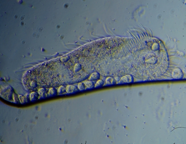 Paramecium