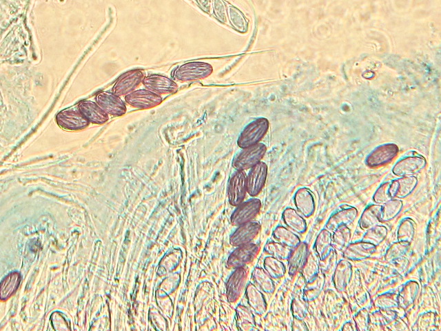 Ascobolus?