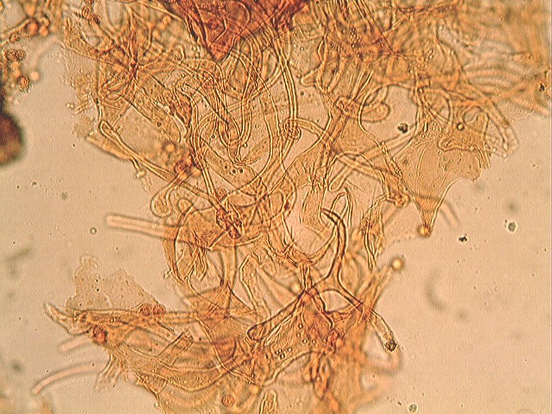 che mixomicete  ?  - Lycogala sp.