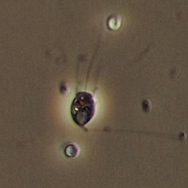 Coanoflagellato