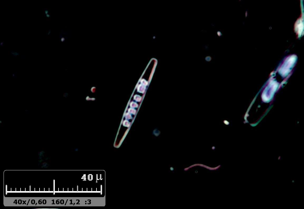 Diatomea+batterio EDF