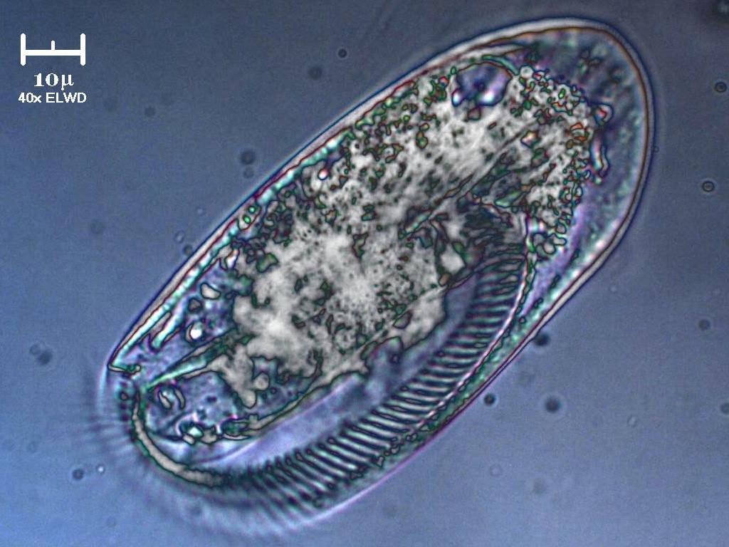 Etica dell''utilizzo di filtri software in microscopia