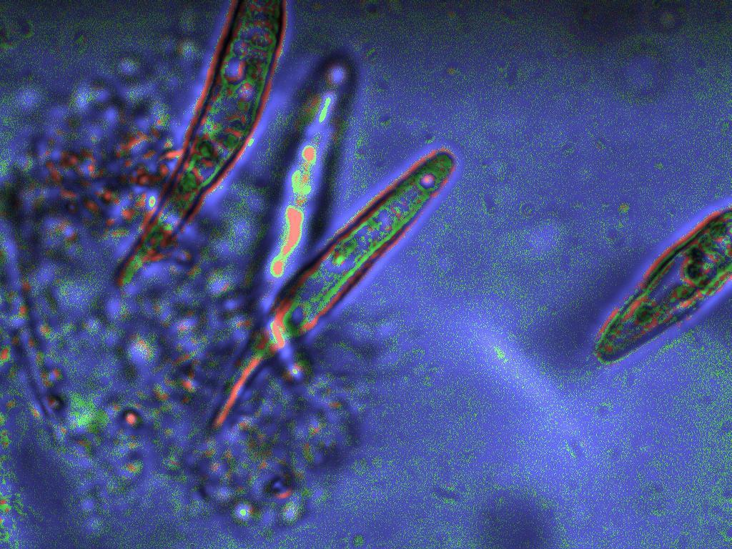 Etica dell''utilizzo di filtri software in microscopia