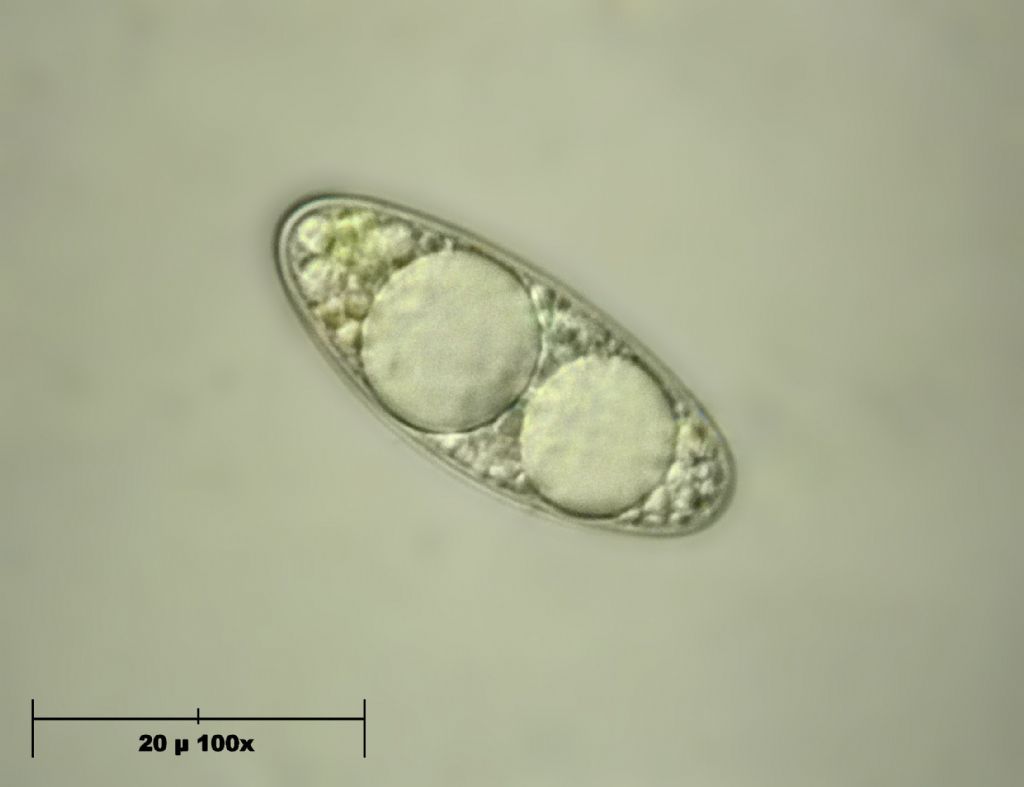 Geopora sumneriana - asco con spore