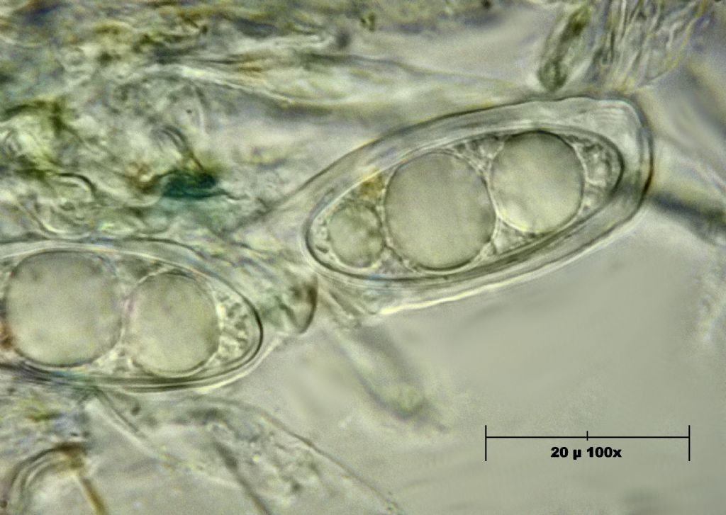 Geopora sumneriana - asco con spore