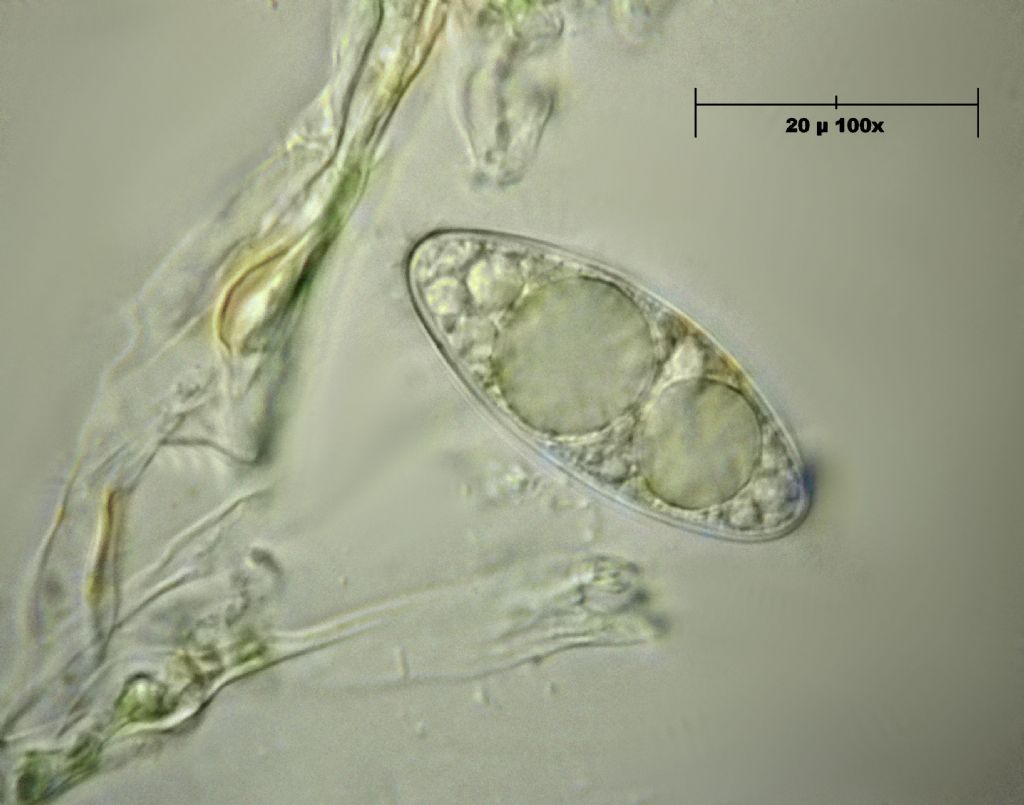 Geopora sumneriana - asco con spore