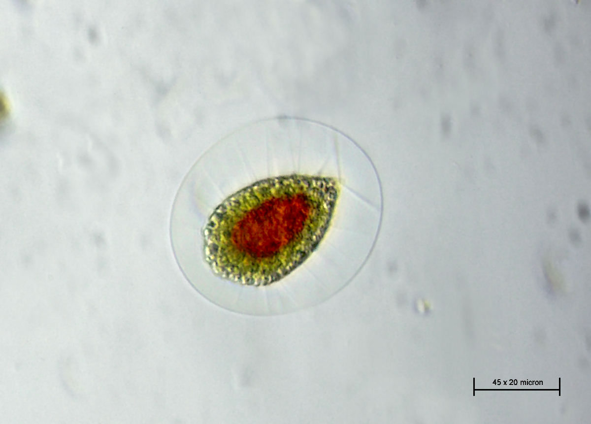 sono tornati - Haematococcus pluvialis