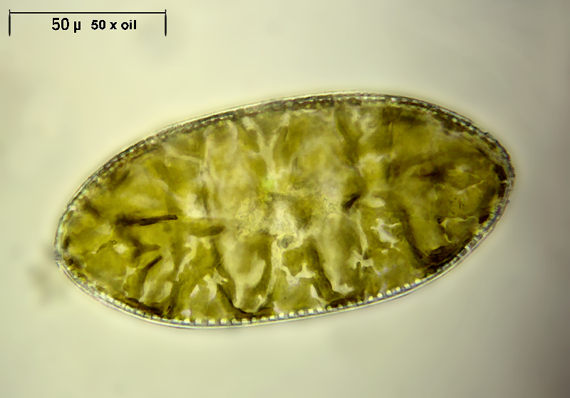 Cymatopleura elliptica