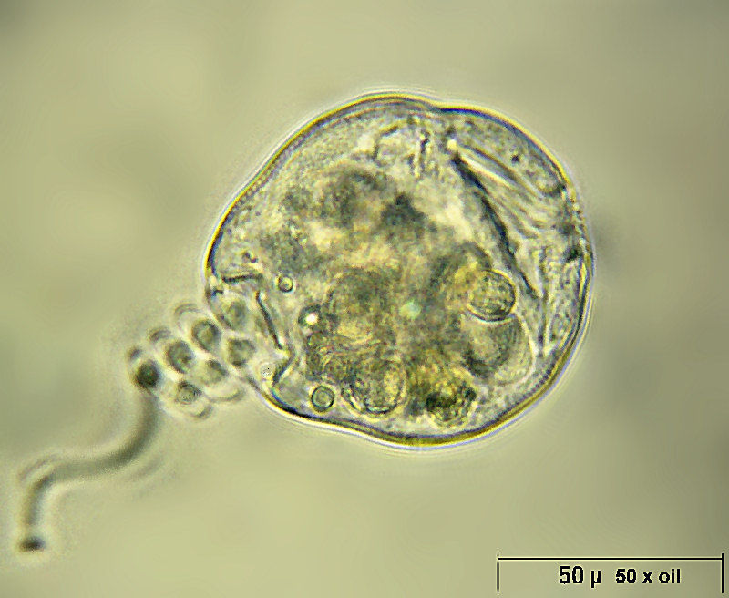 Vorticella