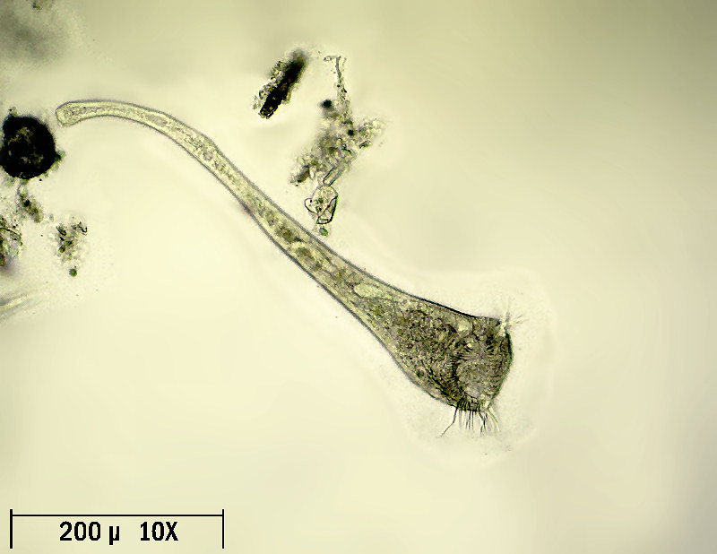 Stentor sp.  - ancorato e vagante